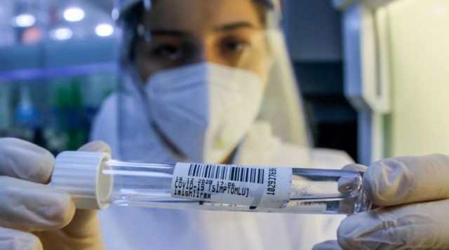 In the last day, 214 people were infected with coronavirus in Azerbaijan, and 2 people died