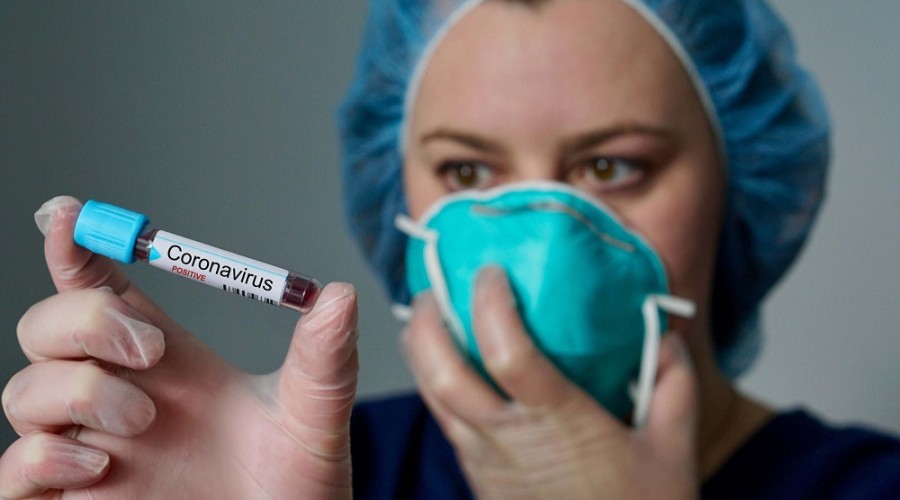 В Азербайджане за прошедшие сутки выявлено 35 случаев заражения коронавирусом