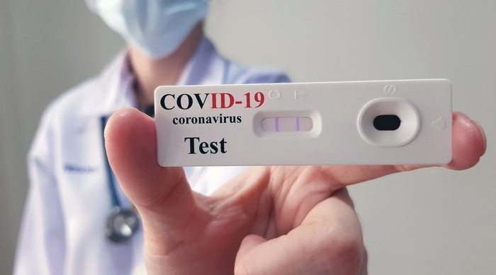 Azerbaijan records 31 new COVID cases