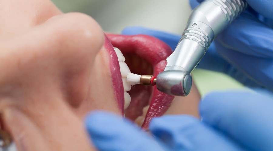 Чистить зубы нужно тщательно: бактерии полости рта могут спровоцировать воспаление мозга