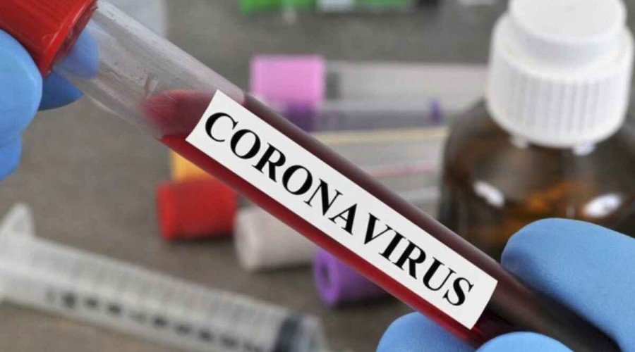 Georgia's coronavirus cases exceed 589.000