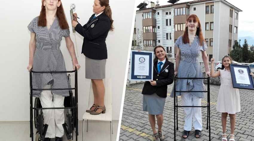 Turkish citizen confirmed as tallest woman