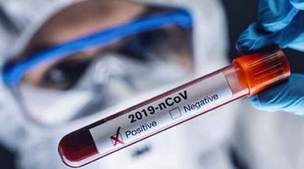 Armenia records 57 coronavirus related deaths over past day