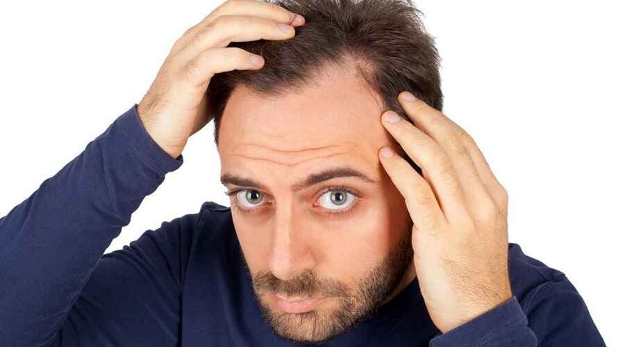 Выпадение волос: за этим может скрываться дефицит трех веществ