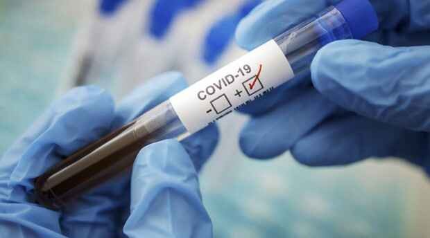 İranda ötən sutkada 80 nəfər koronavirusdan ölüb