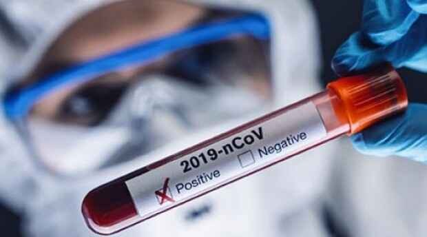 Russia reports nearly 33,000 new coronavirus cases