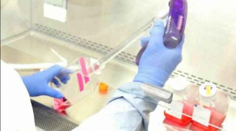 Türkiyədə son sutkada koronavirusdan 198 nəfər öldü