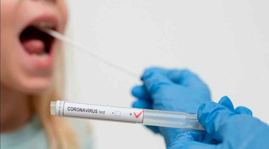 <strong>В Азербайджане за сутки от коронавируса умерли 19 человек</strong>