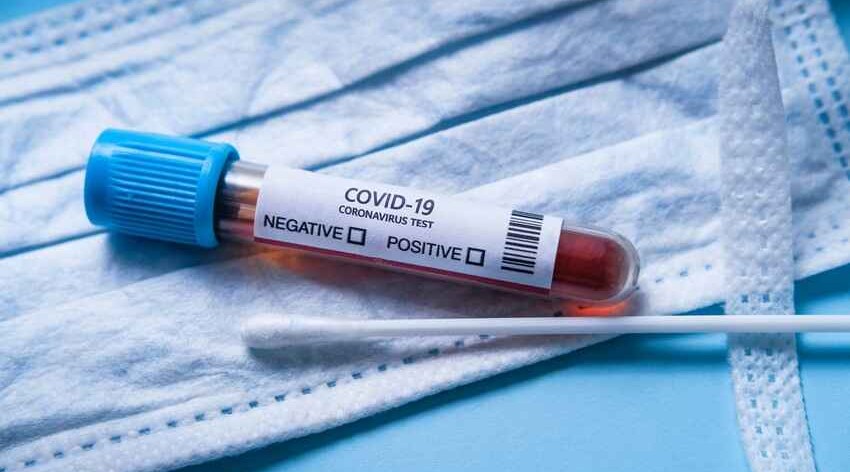 Azərbaycanda daha 755 nəfər koronavirusa yoluxub, 18 nəfər ölüb - <span style="color:red">FOTO</span>