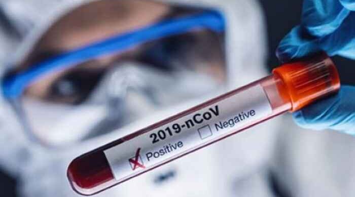 Armenia records 168 coronavirus cases over the past day