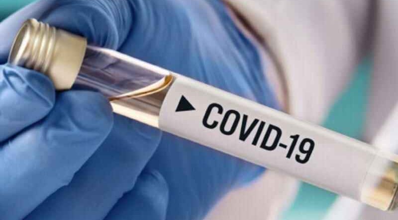 Russia records 31 252 coronavirus cases over past day