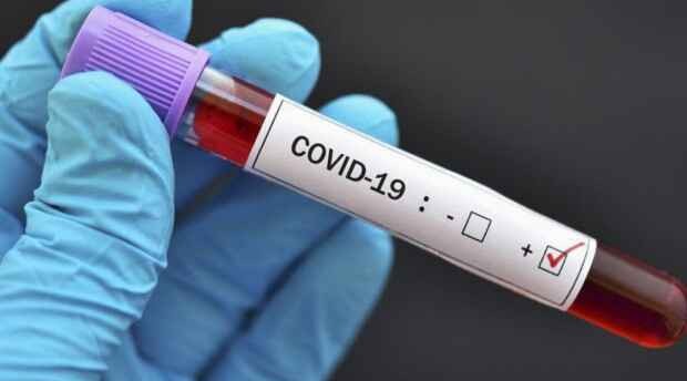 US starts shipping free COVID tests amid Omicron -White House