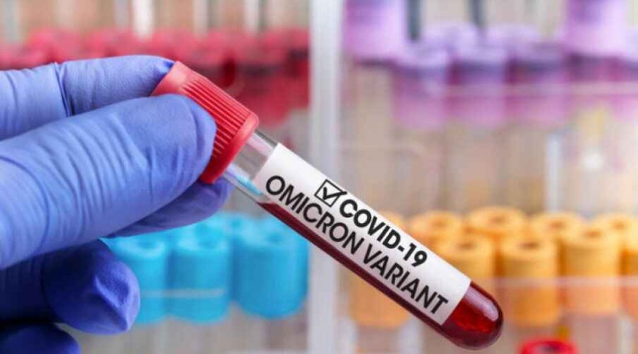 İcbari Tibbi Sığorta Dövlət Agentliyi 5 mln manatlıq koronavirus testi alır