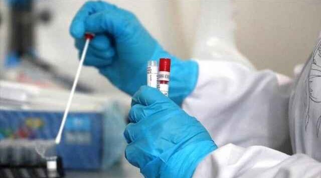 Armenia's coronavirus cases reach 408,381