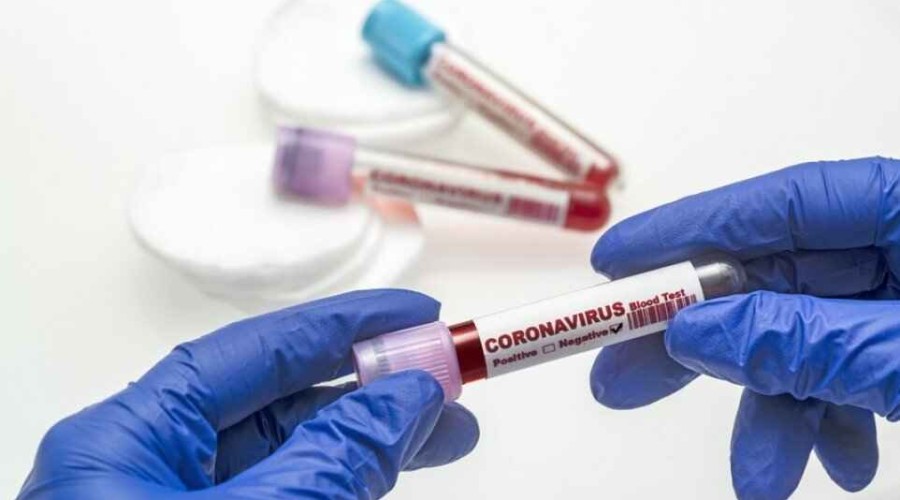 Georgia reports 14,500 new coronavirus cases