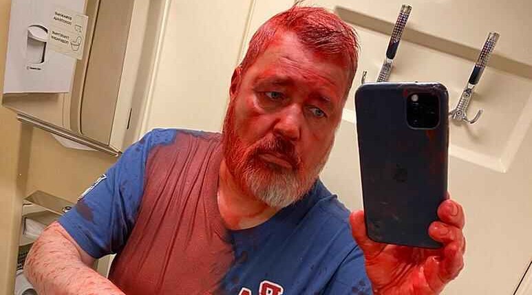 Dmitry Muratov: Russian Nobel Peace Prize-winning editor says he was attacked with red paint