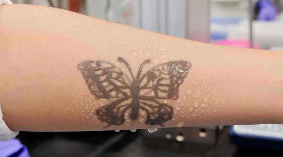 South Korea develops nanotech tattoo as health monitoring device