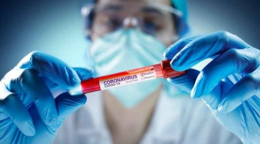 В Азербайджане за последние сутки коронавирусом заразился 121 человек - ФОТО