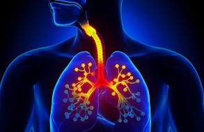Как отличить пневмонию от бронхита?