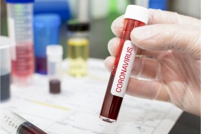 Azerbaijan confirms 90 coronavirus cases today