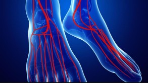 3 признака на ваших ногах, которые сигнализируют о «плохом кровообращении» из-за высокого давления