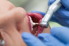 Чистить зубы нужно тщательно: бактерии полости рта могут спровоцировать воспаление мозга