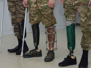 So far, 143 veterans provided with high-tech prostheses in Azerbaijan