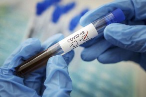 Iran records 238 coronavirus-related deaths over the past day