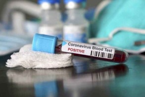 Iran records 112 coronavirus-related deaths over the past day