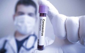 Azərbaycanda daha 2 233 nəfər koronavirusa yoluxub, 28 nəfər ölüb