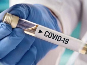 Russia records 31 252 coronavirus cases over past day