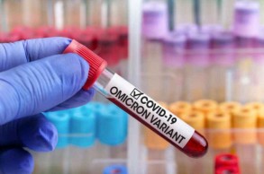 İcbari Tibbi Sığorta Dövlət Agentliyi 5 mln manatlıq koronavirus testi alır