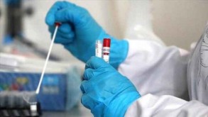 Turkey reports over 92,000 new coronavirus cases