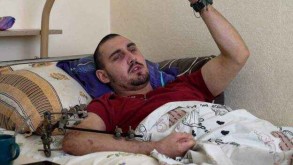 A wounded Ukraine solider but eager to go back to fight