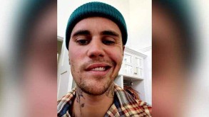 Justin Bieber shares he has Ramsay Hunt syndrome