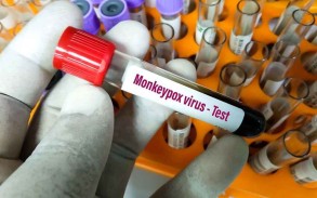 WHO provides monkeypox test kits to Azerbaijan